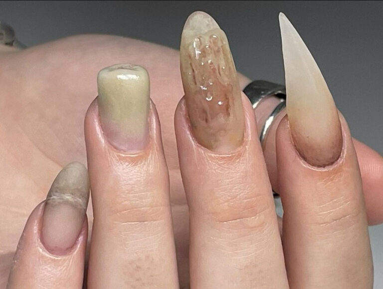 An image of Ugliest Nail Designs
